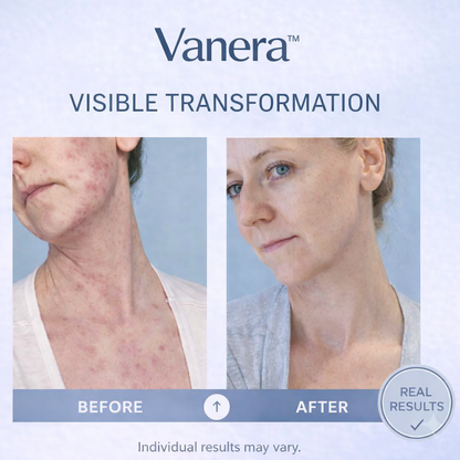Hydration Cream